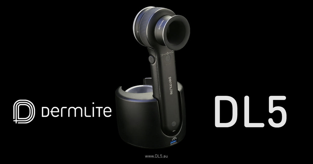 DermLite DL5 Dermatoscope
