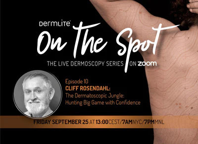 DermLite On the Spot with Prof Cliff Rosendahl