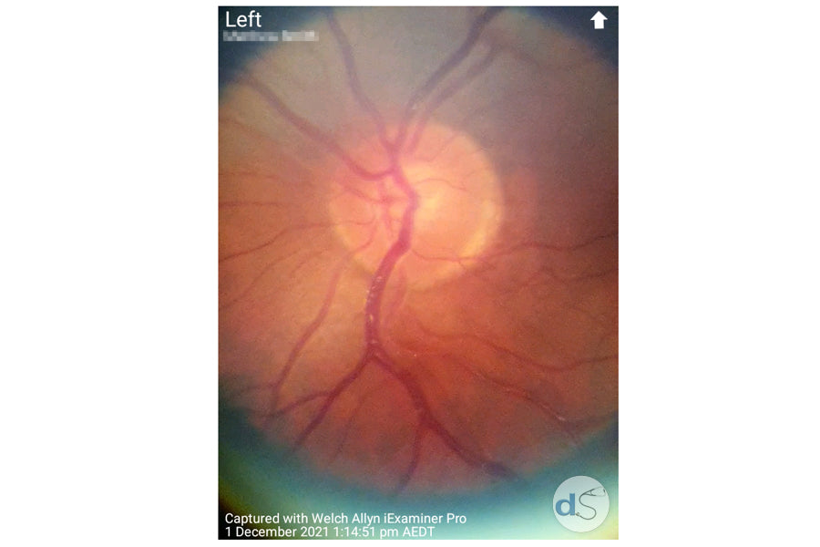 Captured with Hillrom Welch Allyn iExaminer Pro on white background