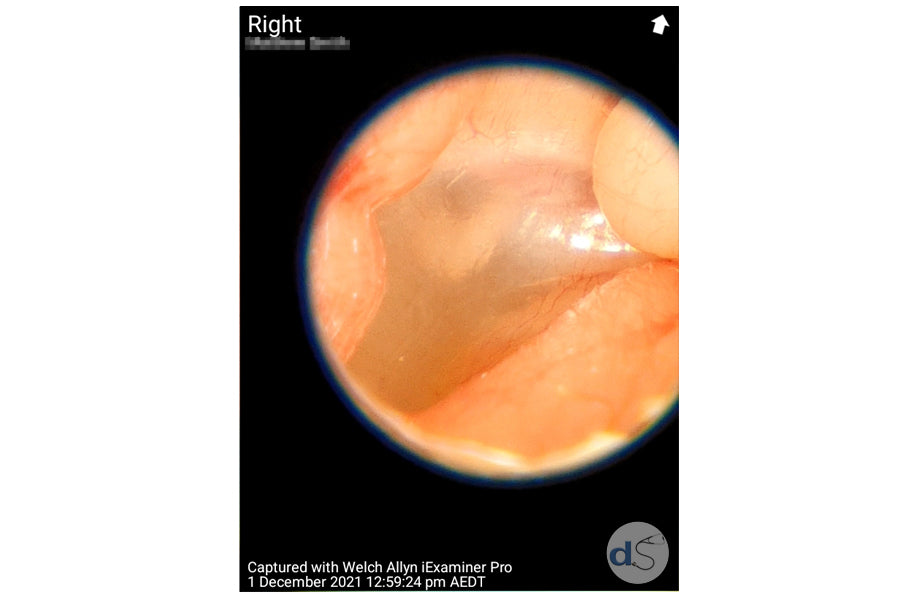 Image captured with Welch Allyn iExaminer Pro 